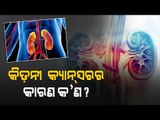 Doctor Doctor | Symptoms & Treatment Of Kidney Cancer