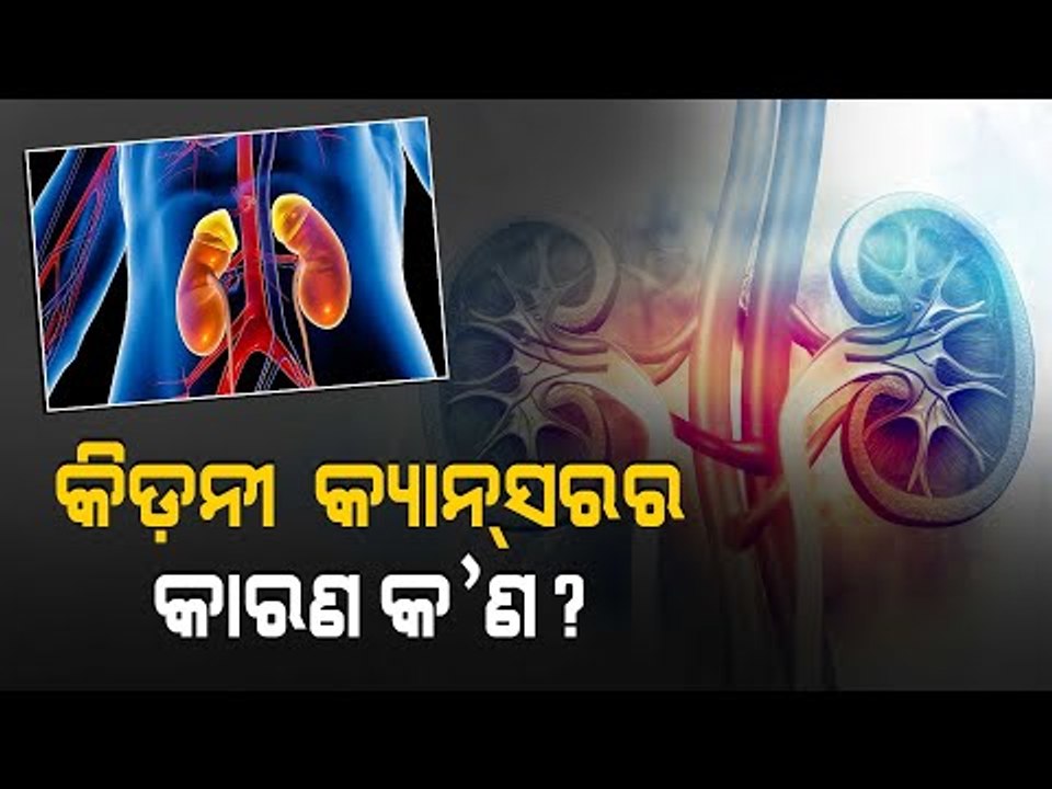 Doctor Doctor | Symptoms & Treatment Of Kidney Cancer