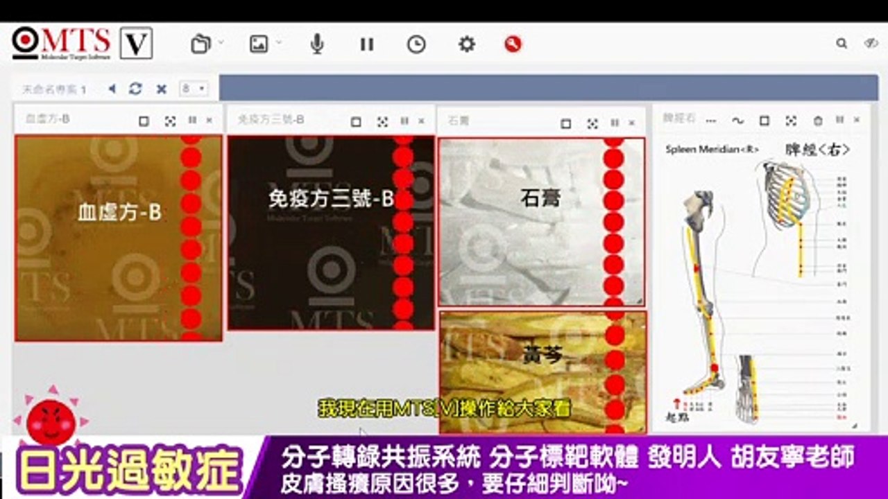 【中文字幕】wellness 日光過敏症 - 皮膚搔癢原因很多，要仔細判斷呦~