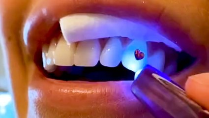 This $25 kit from Gemzeez gives you temporary tooth gems– here's how to apply them