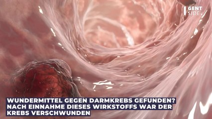 Download Video: Wundermittel gegen Darmkrebs gefunden? Nach Einnahme dieses Wirkstoffs war der Krebs verschwunden