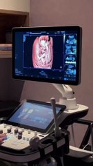 Gravidez de Camila Rodrigues: atriz compartilhou vídeo do ultrassom