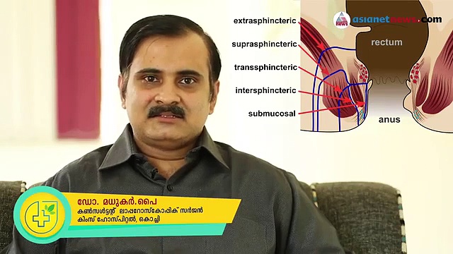 ഫിസ്റ്റുല എങ്ങനെ  എളുപ്പത്തില്‍ മാറ്റാം ?