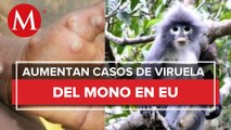 Aumentan a 21 los casos de viruela del mono en Estados Unidos