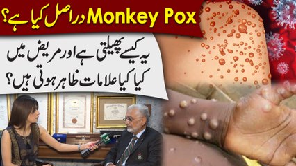 Monkey Pox darr asl kia hai? Ye kese phelti hai aur mareez mei kia alamaat zahir hoti hain?