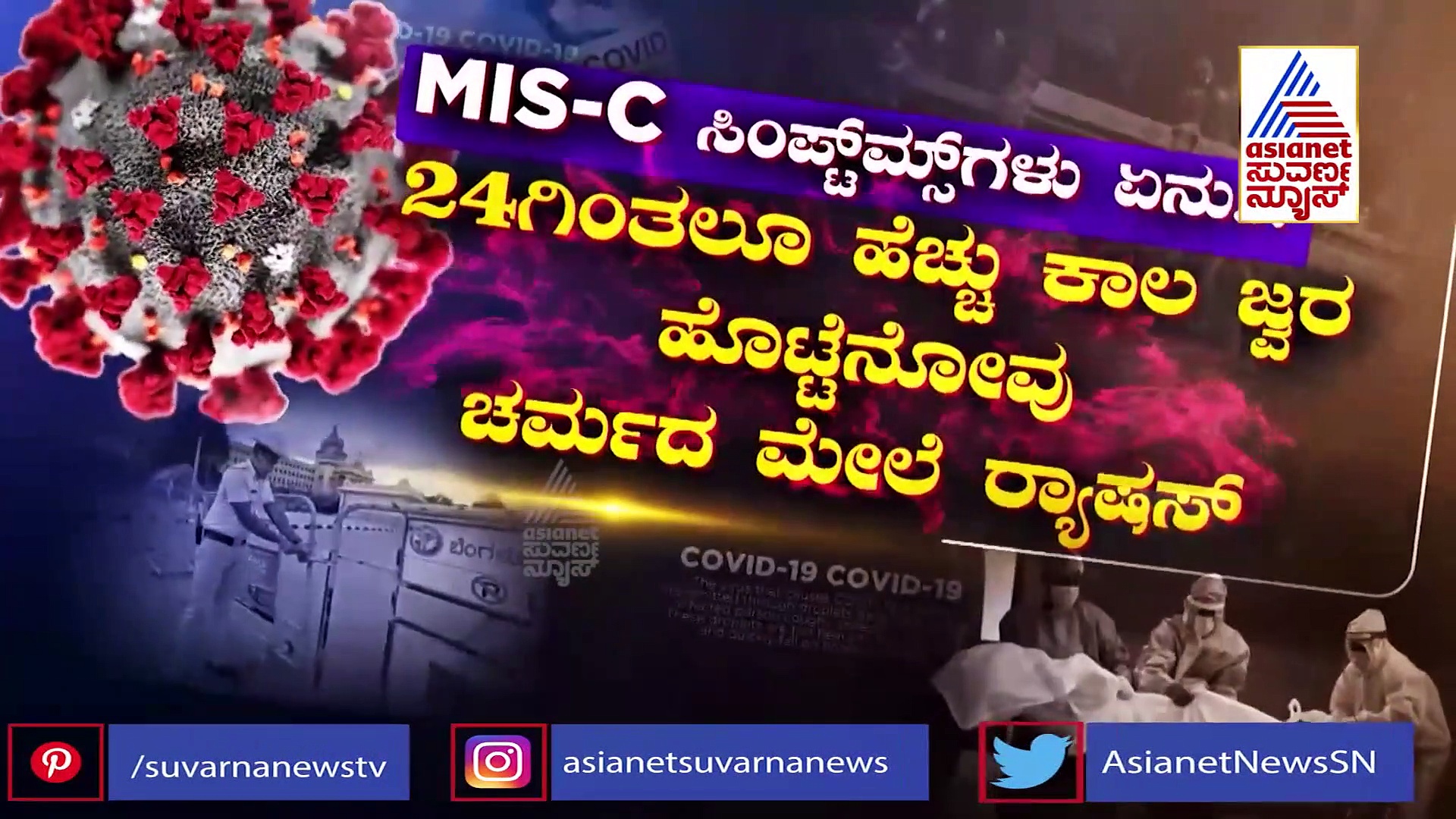 ಕೊರೋನಾದಿಂದ ಗುಣಮುಖರಾದ ಮಕ್ಕಳಲ್ಲಿ MIS- C ಸಿಂಡ್ರೋಮ್