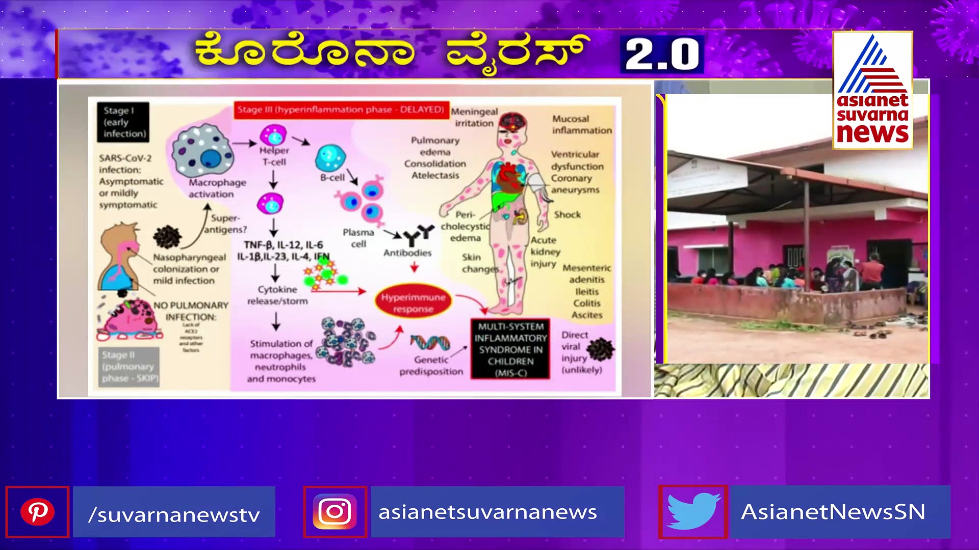 ಕೋವಿಡ್‌ನಿಂದ ಗುಣಮುಖರಾದರೂ ಮಕ್ಕಳಿಗೆ ಕಾಡುತ್ತಿದೆ 'ಕವಾಸಕಿ' ಕಂಟಕ