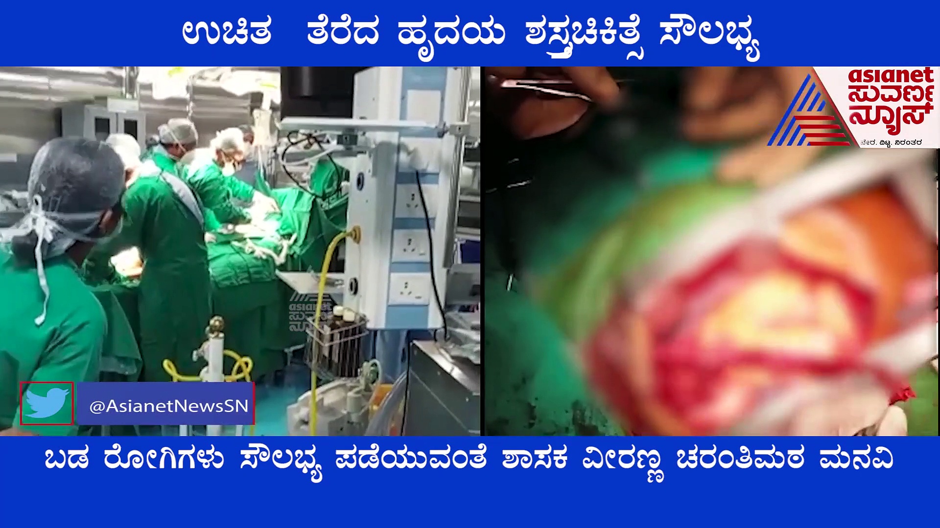 Bagalkot: ಕುಮಾರೇಶ್ವರ ಆಸ್ಪತ್ರೆಯಲ್ಲಿ ಬಡ ರೋಗಿಗಳಿಗೆ ಉಚಿತ ಹೃದಯ ಶಸ್ತ್ರ ಚಿಕಿತ್ಸೆ