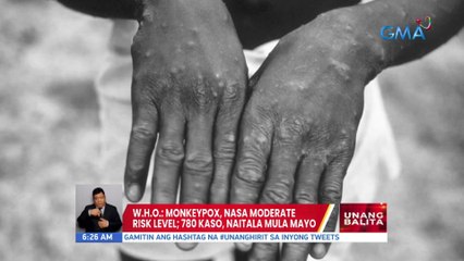 WHO: Monkeypox, nasa moderate risk level; 780 kaso, naitala mula Mayo | UB