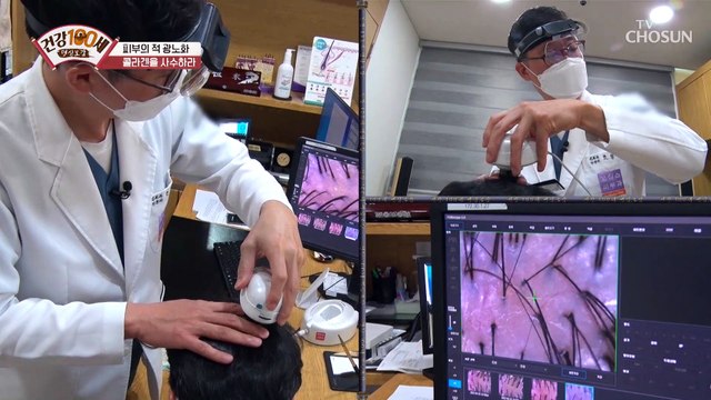 콜라겐으로 두피 노화와 탈모를 예방할 수 있다?! TV CHOSUN 220606 방송