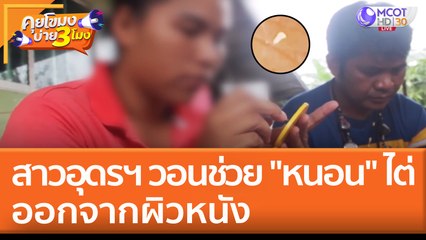 สาวอุดรฯ วอนช่วย "หนอน" ไต่ออกจากผิวหนัง (6 มิ.ย. 65) คุยโขมงบ่าย 3 โมง