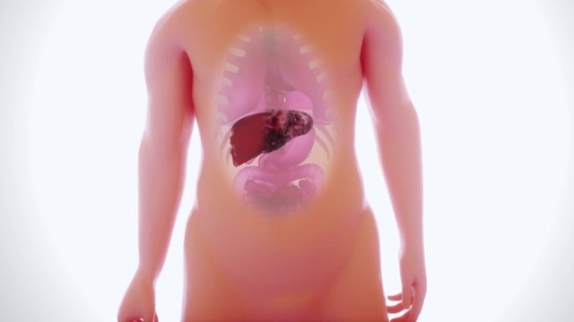 bd-higado-graso-tratamientos-efectivos-060622