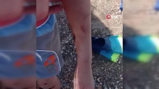 Antalya'nın dünyaca ünlü sahilinde kirlilik alarmı