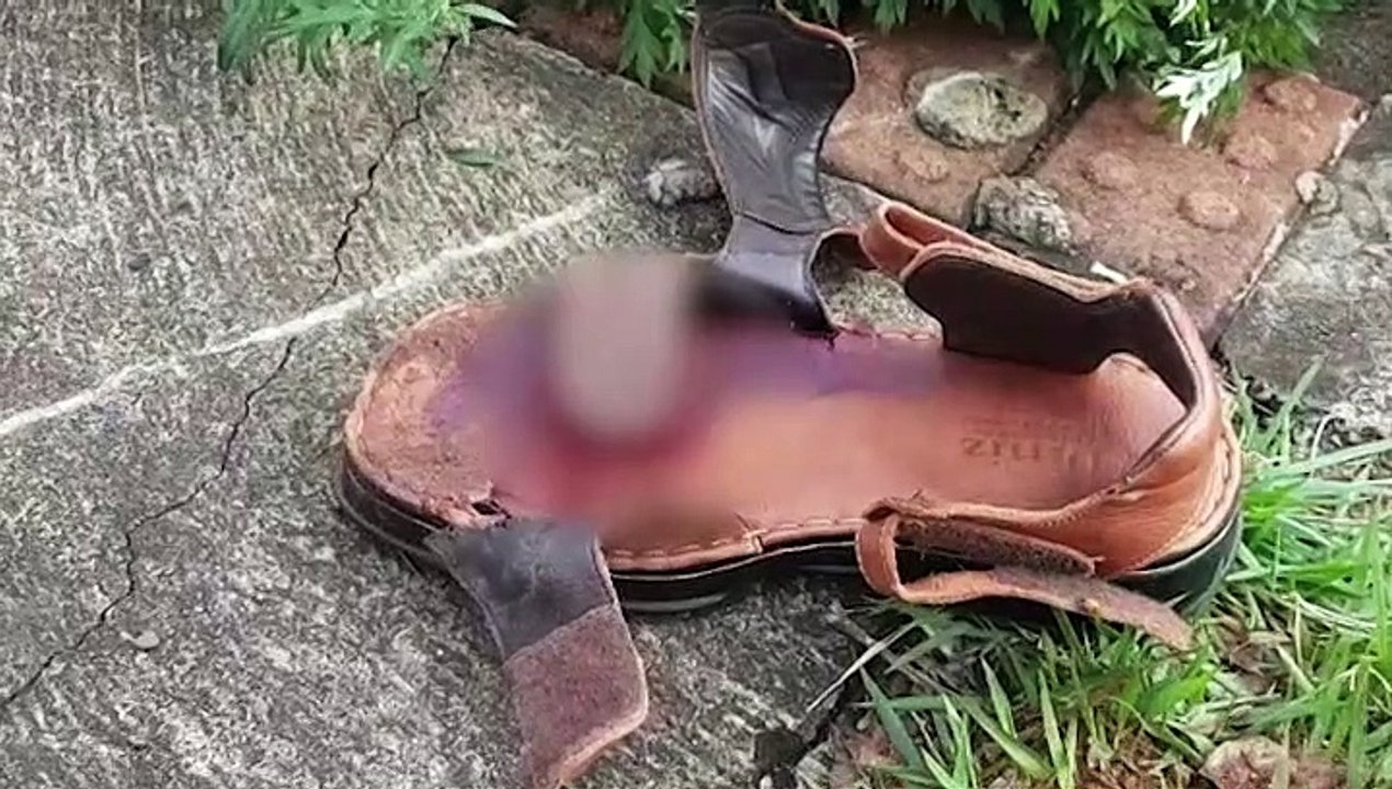 Colisão entre motocicletas deixa três pessoas feridas; homem teve três dedos amputados