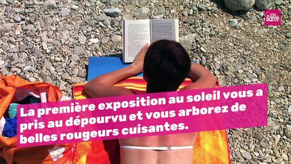 3 remèdes de grand-mère pour calmer un coup de soleil