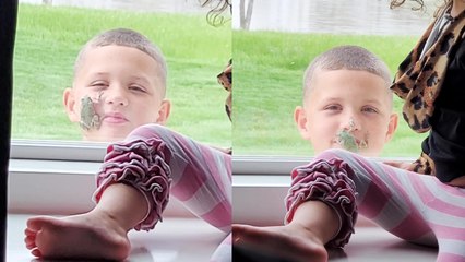 '7 y/o boy shows up outside the window of his house with a tree frog on his face '
