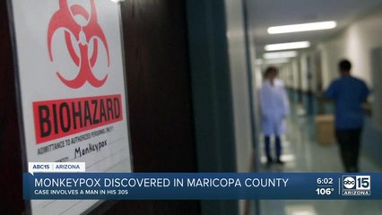 First probable case of monkeypox reported in Arizona