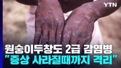 원숭이두창도 2급 감염병..."증상 사라질 때까지 격리" / YTN