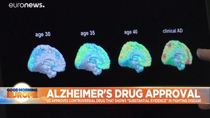Breakthrough or hype? US approves much-debated new Alzheimer's drug