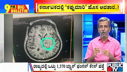 Big Bulletin | New Version Of Black Fungus Found In Bengaluru | HR Ranganath | June 01, 2021