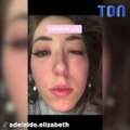 Cette femme a vu son visage complètement se déformer après avoir fait une extension de cils !