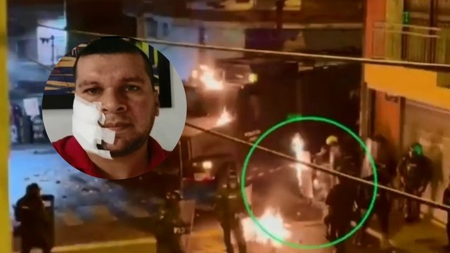 Tengo quemaduras en cara y cuello , policía atacado con bomba molotov en Antioquia