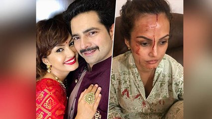 Karan Mehra ने Wife Nisha Rawal की इस हरकत पर किया बड़ा खुलासा, MUST WATCH | Boldsky