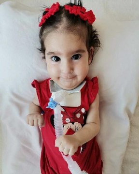 Son dakika haberi: SMA'LI ELİF BEBEK HAYATINI KAYBETTİ, TOPLANAN 2,4 MİLYON LİRA DİĞER HASTALARA DAĞITILACAK