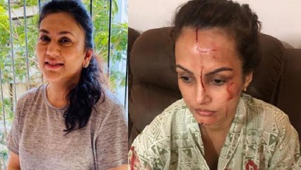 Nisha Rawal के जख्म देख खौला सीता मां aka Dipika Chikhlia का खून, कहा Karan ने उसे मारा | FilmiBeat