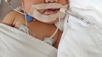 "자연주의 출산이라더니...아기 방치해 뇌 손상" / YTN