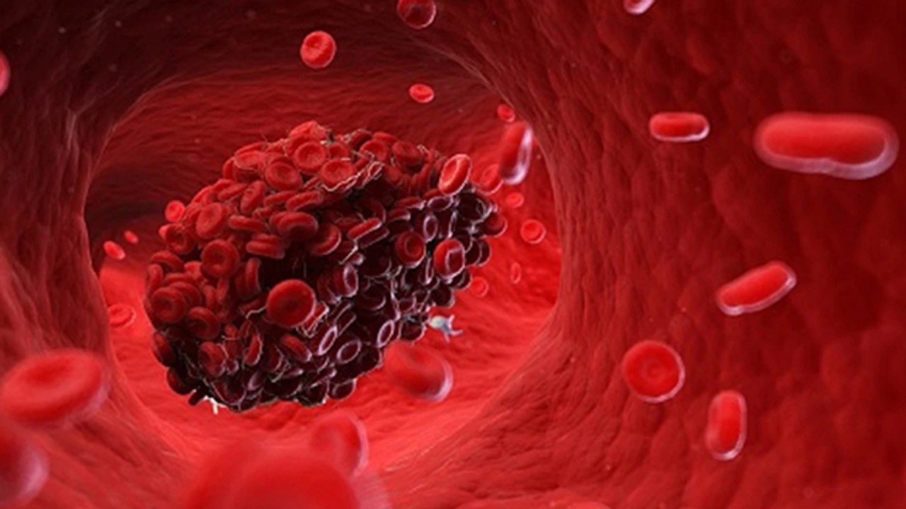 Covishield से Blood Clotting का हो सकता है डर ? | Boldsky