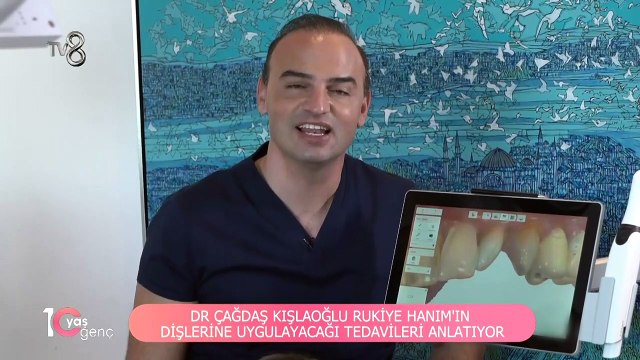 Gülüş Tasarımı Uygulaması Nedir, Nasıl Yapılır_