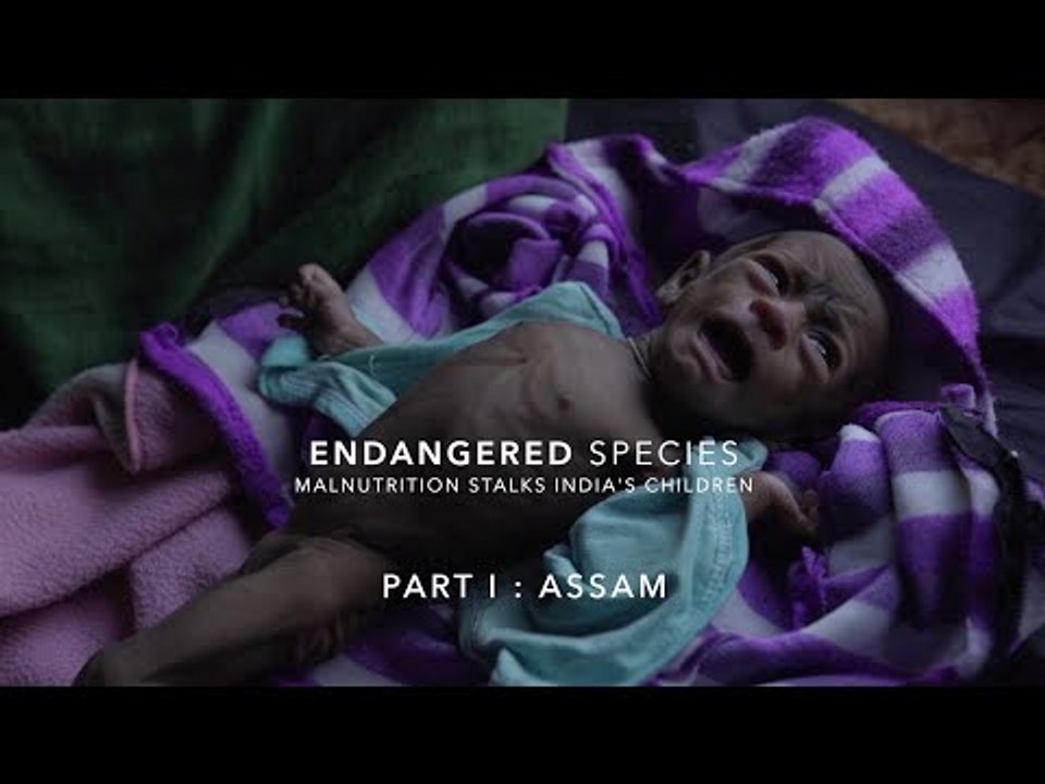 Why Are Most of India's Malnourished Children in Assam? | The Wire