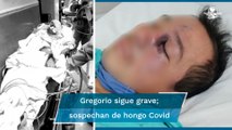 Hongo negro. Extirpan a Gregorio ojo y tejido por sospecha de hongo Covid; sigue grave