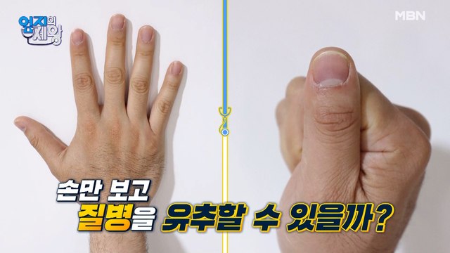 손을 보면 질병이 보인다?! ★집에서 쉽게 하는 당뇨 자가진단!★