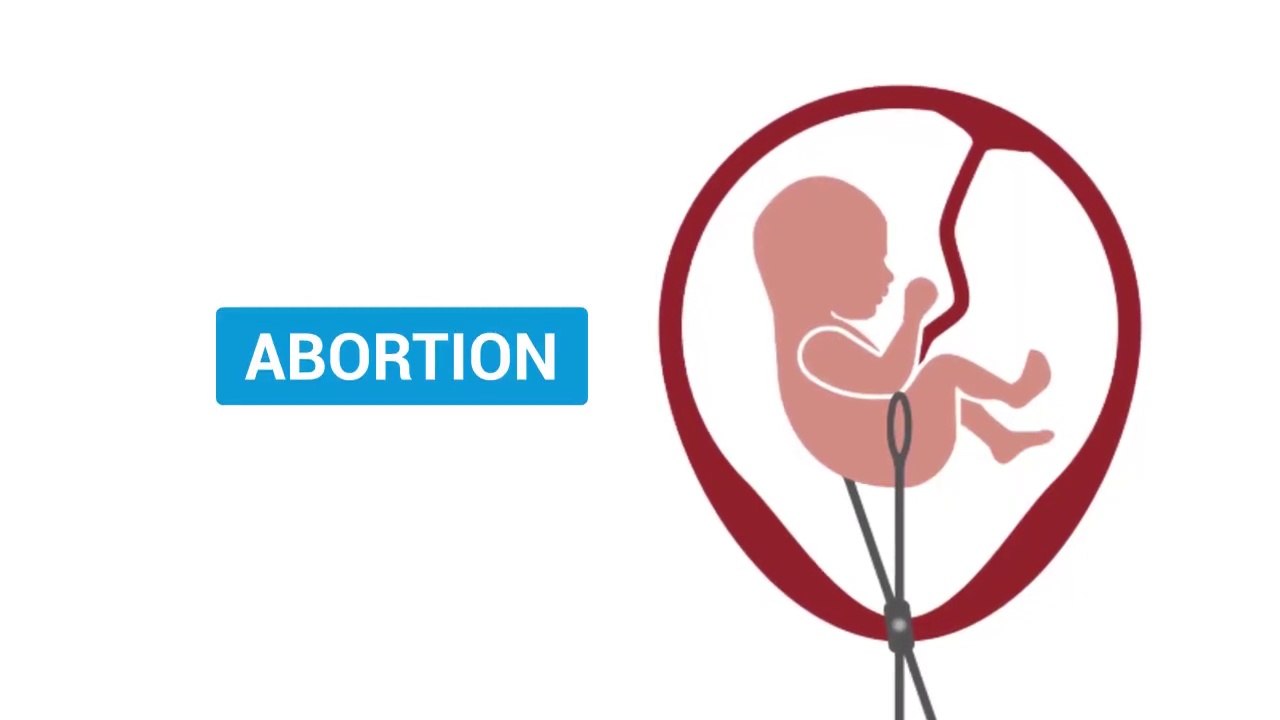 An Interesting Position on Abortion