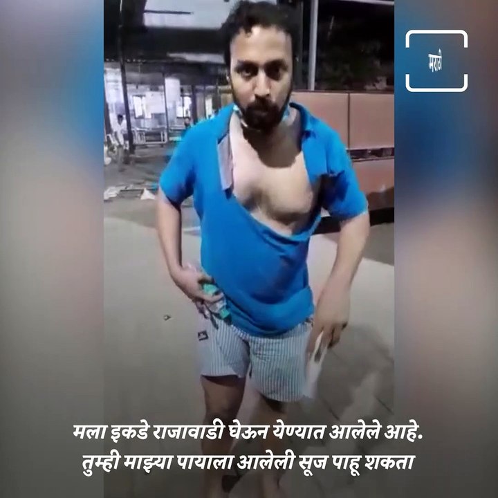 "They Brutally Beat Me For Not Wearing A  Mask" Man Alleges About Chembur Police