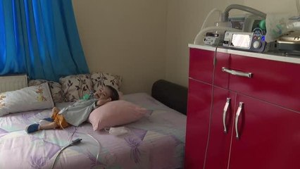Göğüs kafesi genişletilen 1,5 yaşındaki bebek solunum cihazından kurtuldu