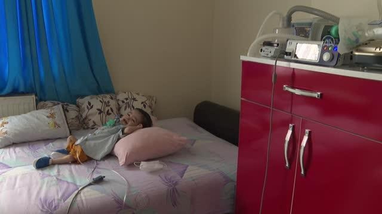 Göğüs kafesi genişletilen 1,5 yaşındaki bebek solunum cihazından kurtuldu
