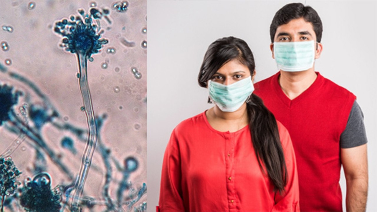 Black Fungus का Face पर साफ दिखता है Symptoms, भूलकर ना करें नजरअंदाज | Boldsky