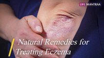 चर्म रोग दूर करने के आयुर्वेदिक व घरेलू उपाय | Natural Remedies for Treating Eczema | Life Mantraa