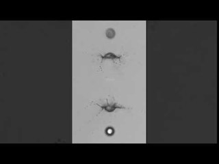 Ultra-intense laser meets tiny water droplet