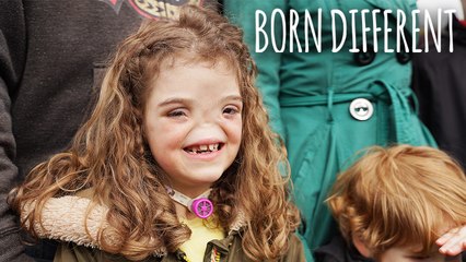The Girl Born Without A Nose | BORN DIFFERENT