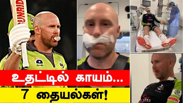 PSL 2021: Ben Dunk of Lahore Qalanders injured | OneIndia Tamil