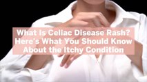 What Is Celiac Disease Rash? Here’s What You Should Know About the Itchy Condition