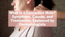 What Is a Cancerous Mole? Symptoms, Causes, and Treatments, Explained by Dermatologists