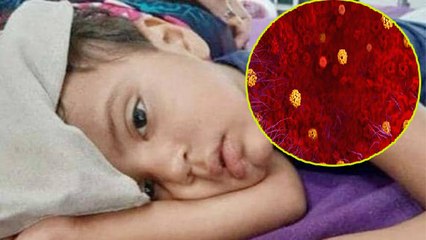 Coronavirus के बाद इस Fever ने बढ़ाई Doctors की परेशानियां, जानलेवा है बीमारी ! | Boldsky