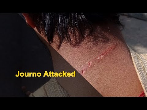 Reporter, Video Journalist Thrashed By Mob In Puri | OTV News