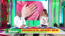 ¿Qué es bueno para curar las quemaduras de sol?