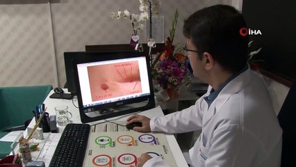 - Kapalı kıl dönmesi ameliyatı ile aynı gün taburcu olmak mümkün